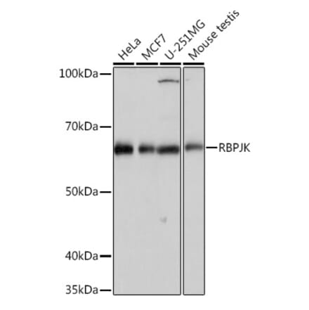 Western Blot - Anti-RBPJK Antibody [ARC0894] (A305486) - Antibodies.com