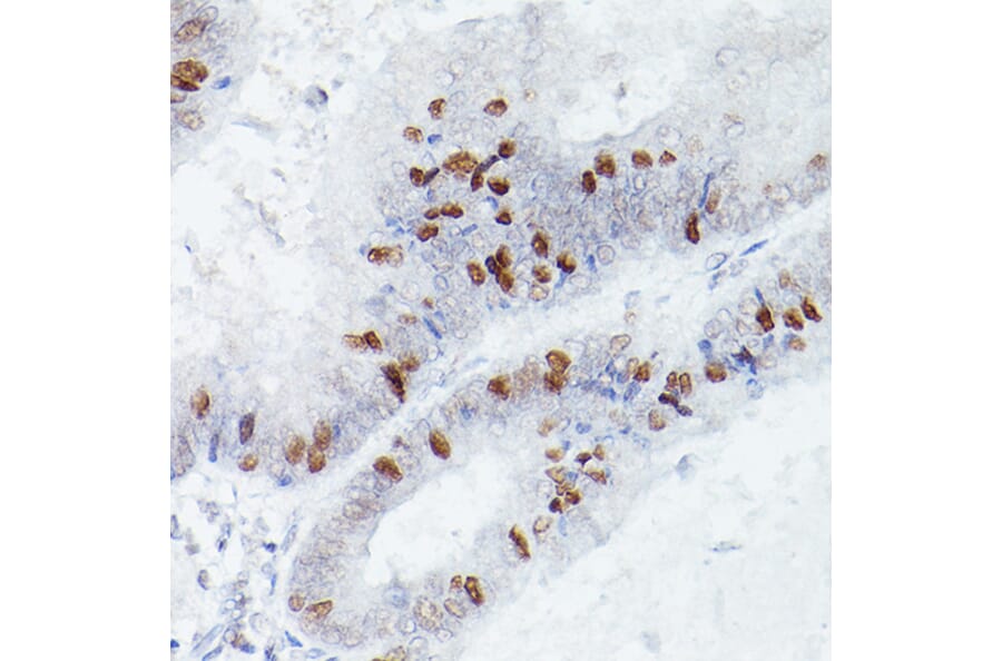 Immunohistochemistry - Anti-RBPJK Antibody [ARC0894] (A305486) - Antibodies.com