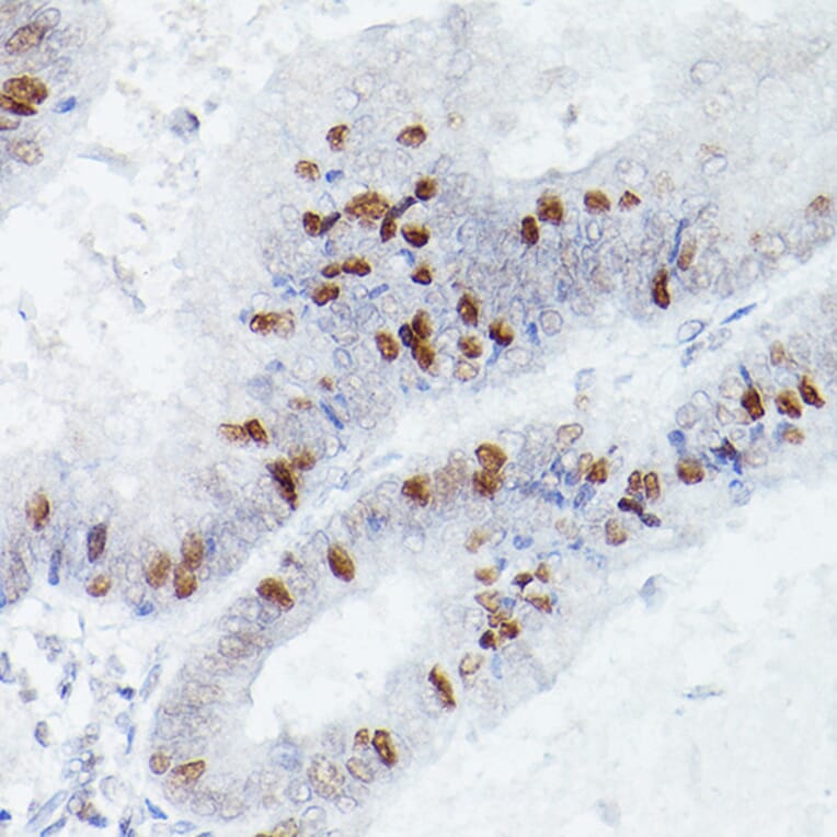 Immunohistochemistry - Anti-RBPJK Antibody [ARC0894] (A305486) - Antibodies.com
