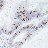 Immunohistochemistry - Anti-RBPJK Antibody [ARC0894] (A305486) - Antibodies.com