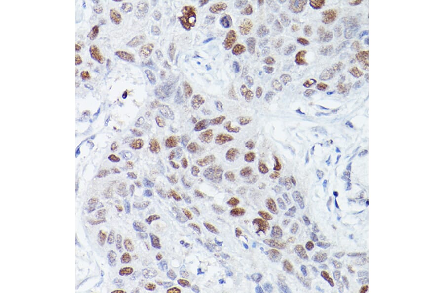 Immunohistochemistry - Anti-RBPJK Antibody [ARC0894] (A305486) - Antibodies.com