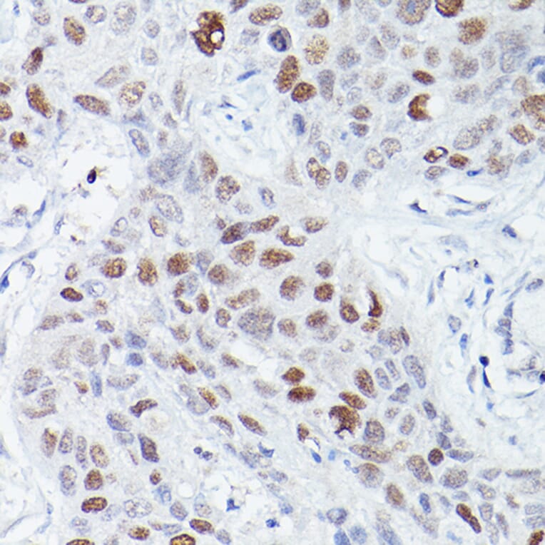 Immunohistochemistry - Anti-RBPJK Antibody [ARC0894] (A305486) - Antibodies.com