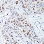 Immunohistochemistry - Anti-RBPJK Antibody [ARC0894] (A305486) - Antibodies.com