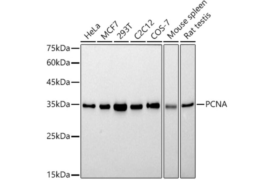 Western Blot - Anti-PCNA Antibody [ARC51324] (A305487) - Antibodies.com