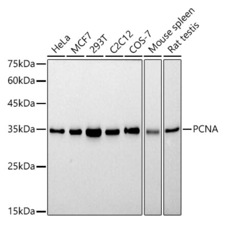 Western Blot - Anti-PCNA Antibody [ARC51324] (A305487) - Antibodies.com