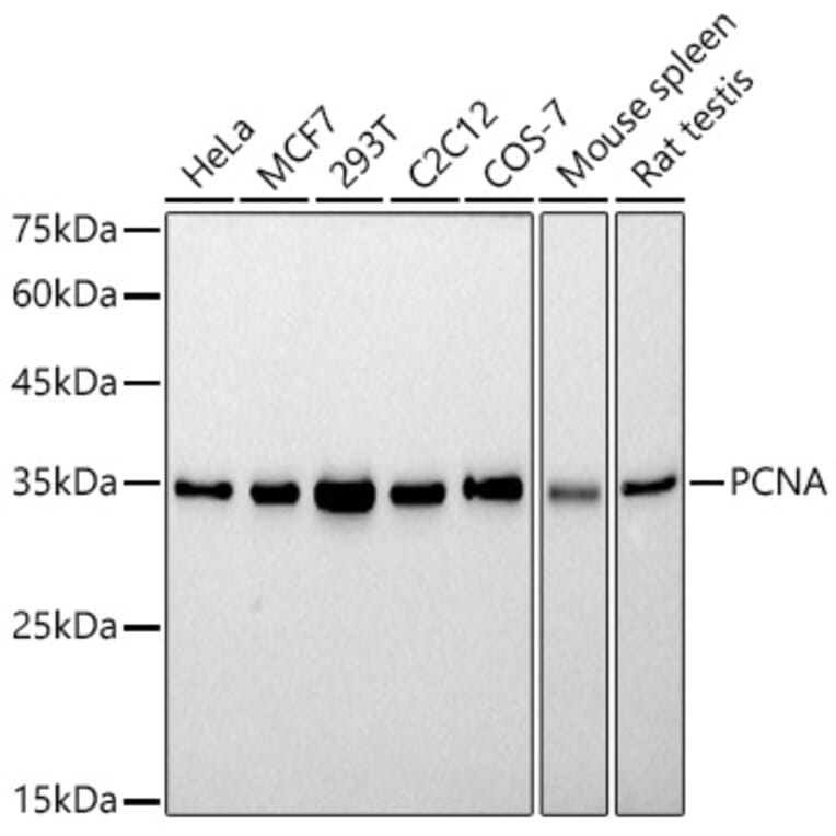 Western Blot - Anti-PCNA Antibody [ARC51324] (A305487) - Antibodies.com
