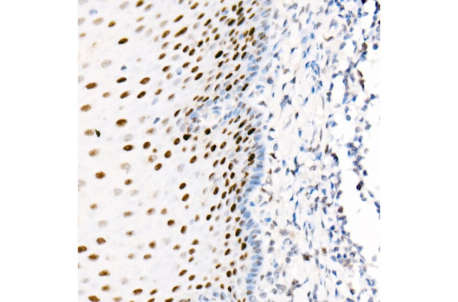Immunohistochemistry - Anti-PCNA Antibody [ARC51324] (A305487) - Antibodies.com