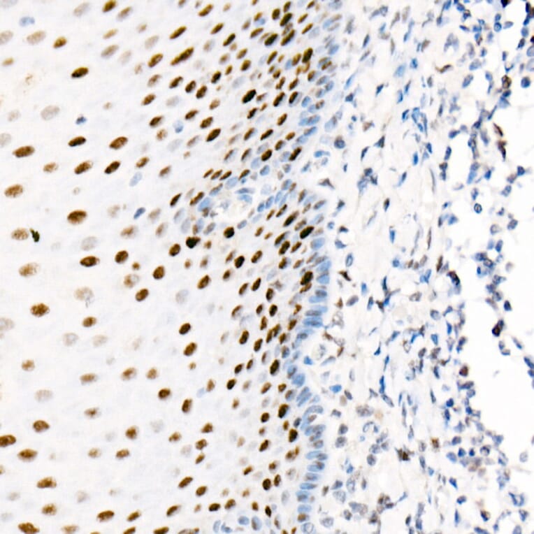 Immunohistochemistry - Anti-PCNA Antibody [ARC51324] (A305487) - Antibodies.com