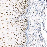 Immunohistochemistry - Anti-PCNA Antibody [ARC51324] (A305487) - Antibodies.com