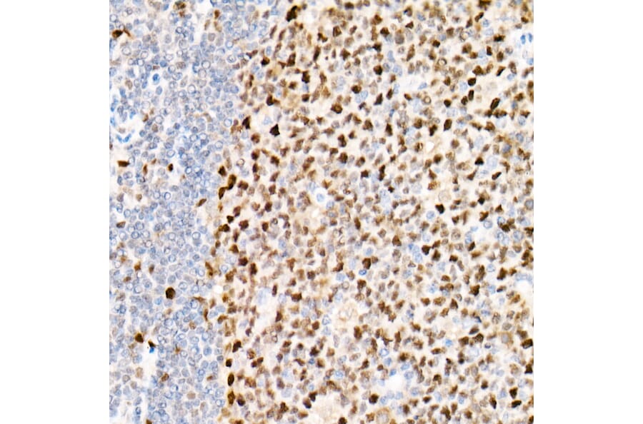 Immunohistochemistry - Anti-PCNA Antibody [ARC51324] (A305487) - Antibodies.com