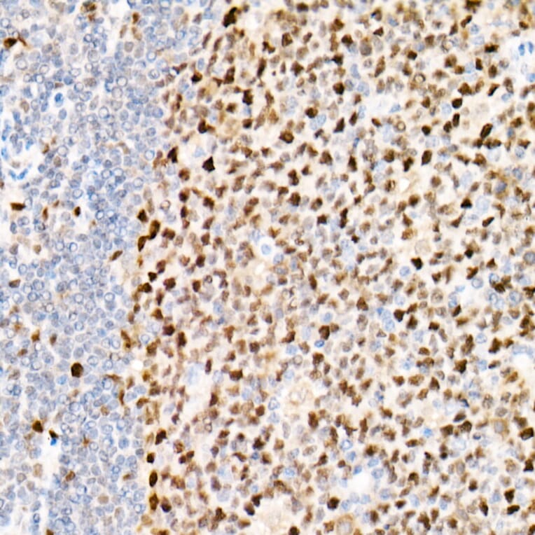 Immunohistochemistry - Anti-PCNA Antibody [ARC51324] (A305487) - Antibodies.com