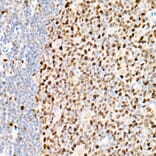 Immunohistochemistry - Anti-PCNA Antibody [ARC51324] (A305487) - Antibodies.com
