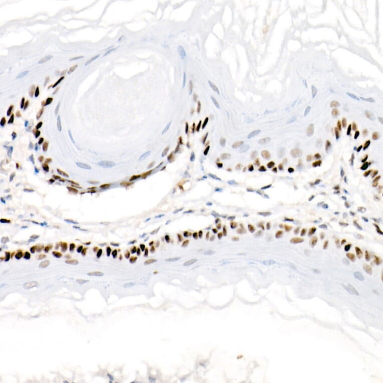 Immunohistochemistry - Anti-PCNA Antibody [ARC51324] (A305487) - Antibodies.com