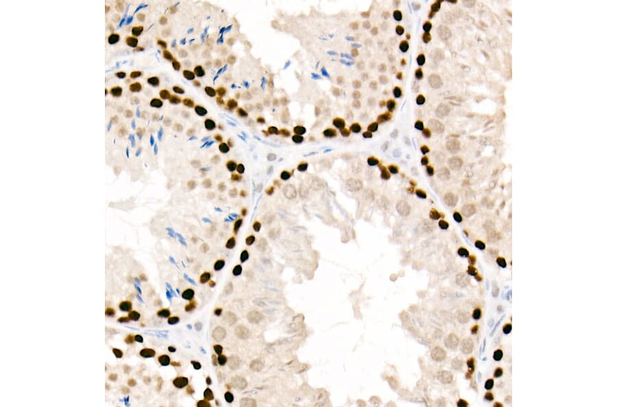 Immunohistochemistry - Anti-PCNA Antibody [ARC51324] (A305487) - Antibodies.com