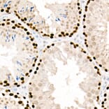 Immunohistochemistry - Anti-PCNA Antibody [ARC51324] (A305487) - Antibodies.com