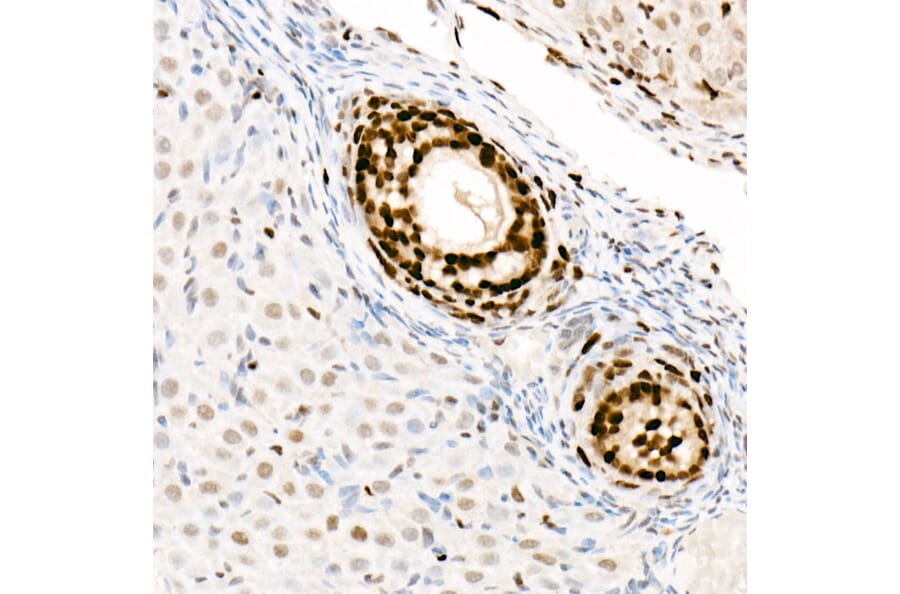 Immunohistochemistry - Anti-PCNA Antibody [ARC51324] (A305487) - Antibodies.com