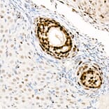 Immunohistochemistry - Anti-PCNA Antibody [ARC51324] (A305487) - Antibodies.com