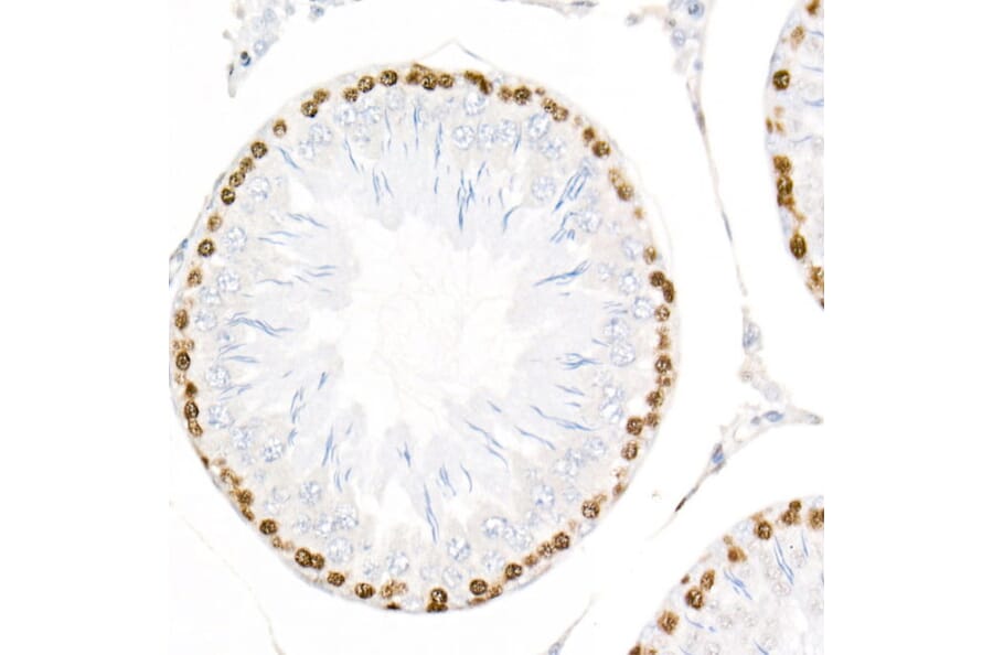 Immunohistochemistry - Anti-PCNA Antibody [ARC51324] (A305487) - Antibodies.com