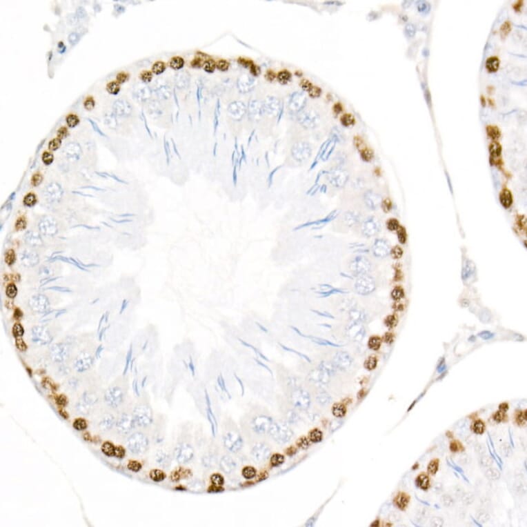 Immunohistochemistry - Anti-PCNA Antibody [ARC51324] (A305487) - Antibodies.com