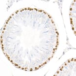 Immunohistochemistry - Anti-PCNA Antibody [ARC51324] (A305487) - Antibodies.com