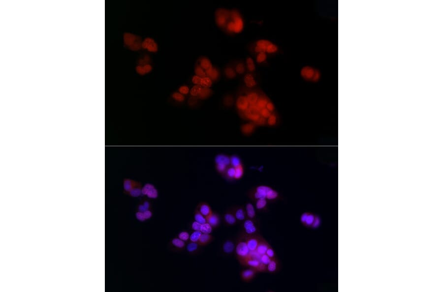 Immunofluorescence - Anti-PCNA Antibody [ARC51324] (A305487) - Antibodies.com