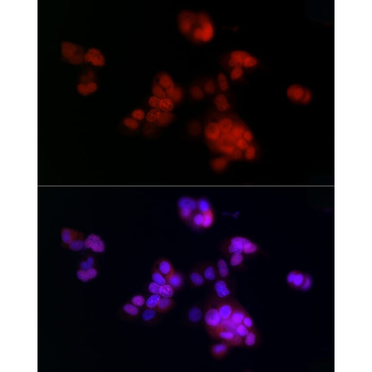 Immunofluorescence - Anti-PCNA Antibody [ARC51324] (A305487) - Antibodies.com