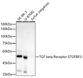 Western Blot - Anti-TGF beta Receptor I Antibody [ARC55592] (A305488) - Antibodies.com