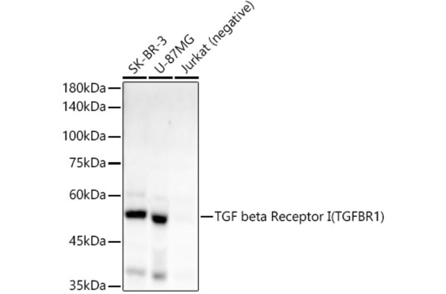 Western Blot - Anti-TGF beta Receptor I Antibody [ARC55592] (A305488) - Antibodies.com
