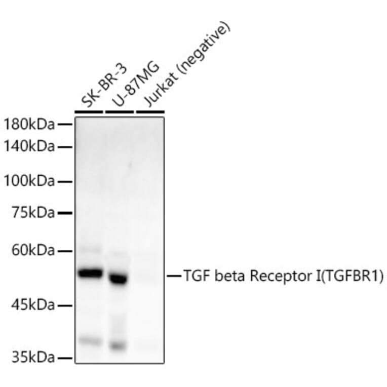 Western Blot - Anti-TGF beta Receptor I Antibody [ARC55592] (A305488) - Antibodies.com