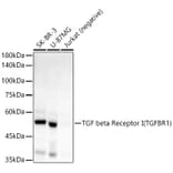 Western Blot - Anti-TGF beta Receptor I Antibody [ARC55592] (A305488) - Antibodies.com