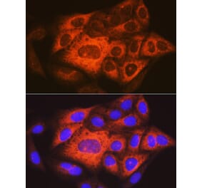 Immunofluorescence - Anti-TACC3 Antibody (A305489) - Antibodies.com