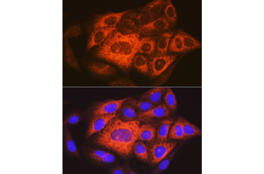 Immunofluorescence - Anti-TACC3 Antibody (A305489) - Antibodies.com