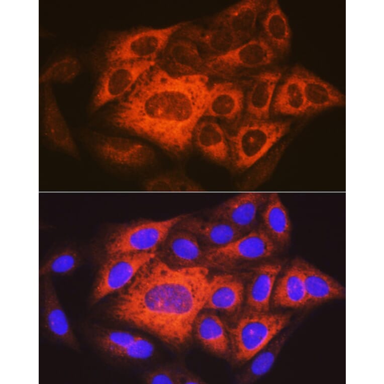 Immunofluorescence - Anti-TACC3 Antibody (A305489) - Antibodies.com