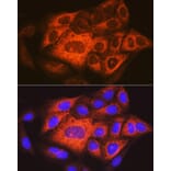 Immunofluorescence - Anti-TACC3 Antibody (A305489) - Antibodies.com