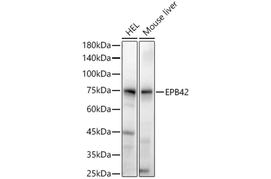 Western Blot - Anti-EPB42 Antibody (A305490) - Antibodies.com