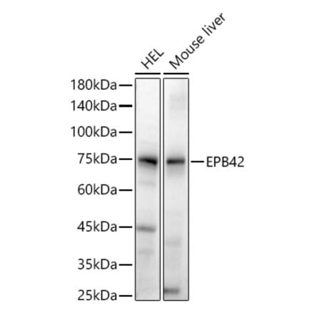 Western Blot - Anti-EPB42 Antibody (A305490) - Antibodies.com