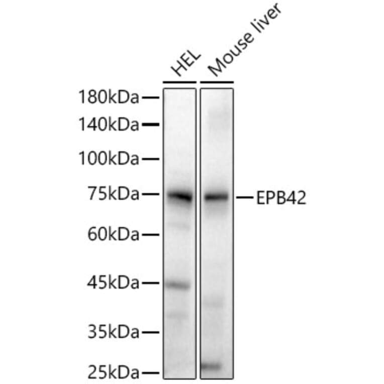 Western Blot - Anti-EPB42 Antibody (A305490) - Antibodies.com