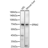 Western Blot - Anti-EPB42 Antibody (A305490) - Antibodies.com