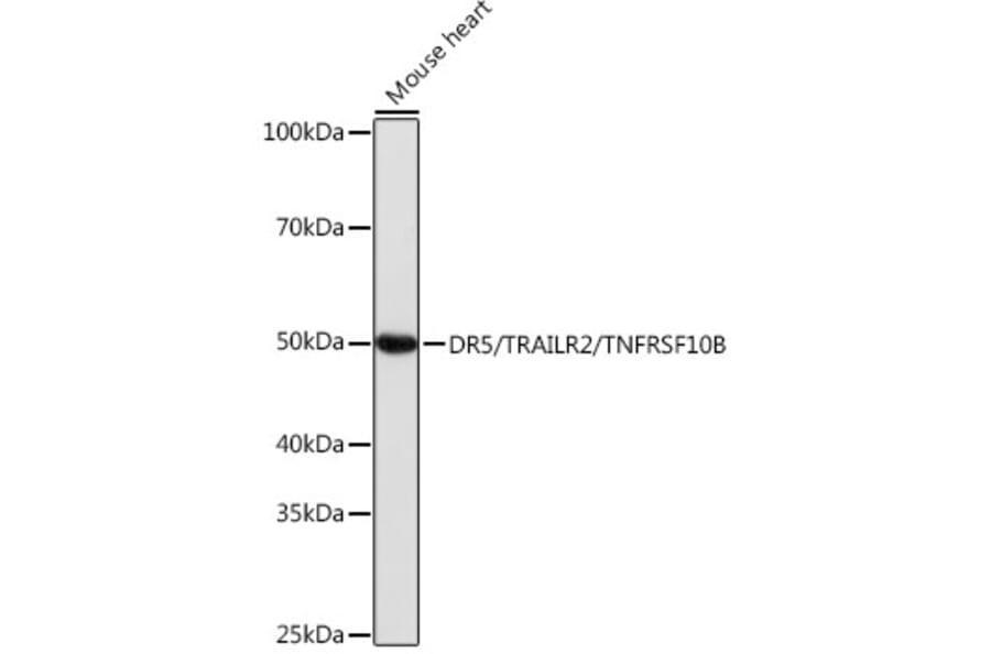 Western Blot - Anti-DR5 Antibody [ARC0406] (A305494) - Antibodies.com
