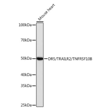 Western Blot - Anti-DR5 Antibody [ARC0406] (A305494) - Antibodies.com