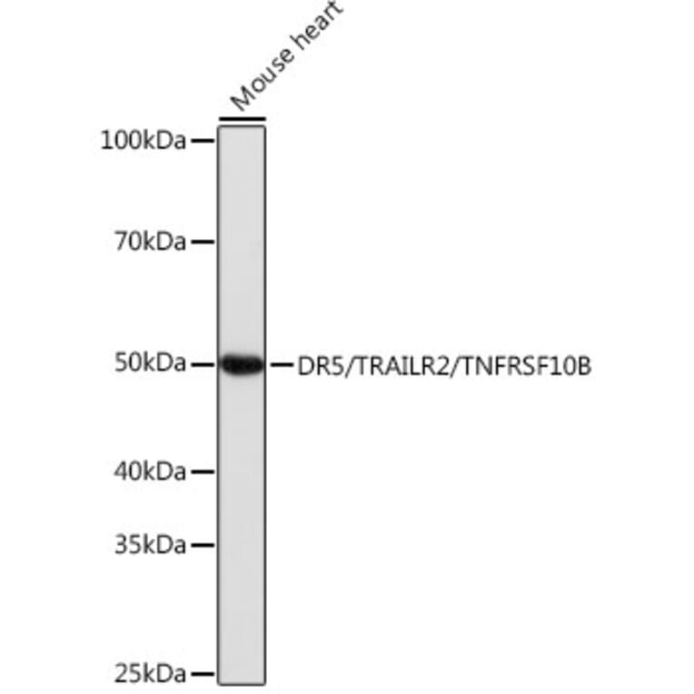 Western Blot - Anti-DR5 Antibody [ARC0406] (A305494) - Antibodies.com
