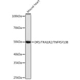 Western Blot - Anti-DR5 Antibody [ARC0406] (A305494) - Antibodies.com