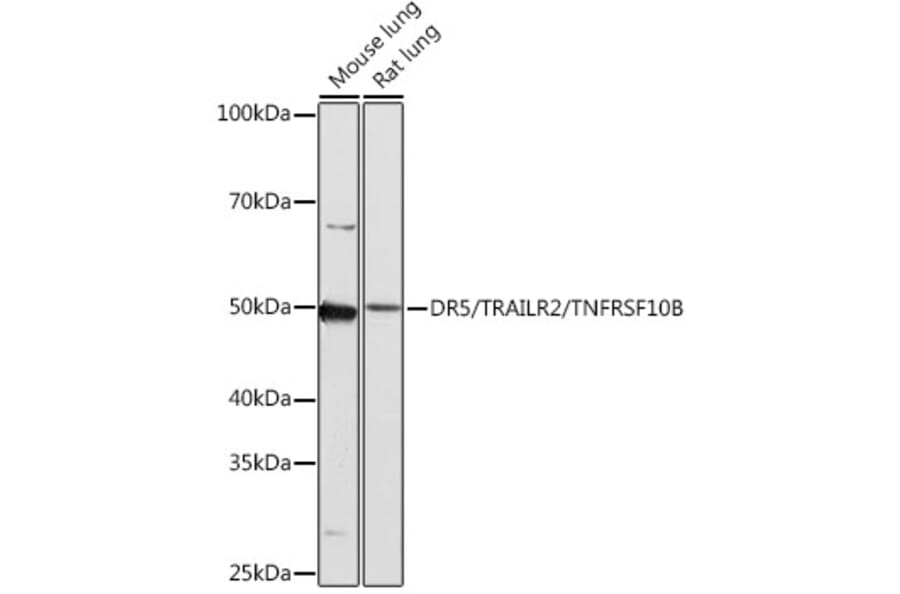 Western Blot - Anti-DR5 Antibody [ARC0406] (A305494) - Antibodies.com