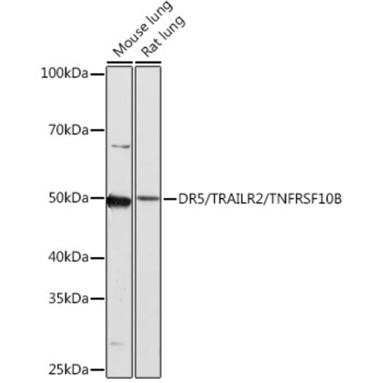 Western Blot - Anti-DR5 Antibody [ARC0406] (A305494) - Antibodies.com