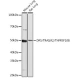 Western Blot - Anti-DR5 Antibody [ARC0406] (A305494) - Antibodies.com