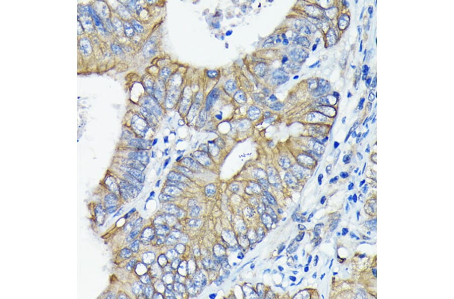 Immunohistochemistry - Anti-DR5 Antibody [ARC0406] (A305494) - Antibodies.com