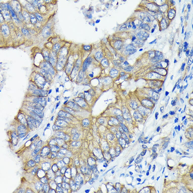 Immunohistochemistry - Anti-DR5 Antibody [ARC0406] (A305494) - Antibodies.com