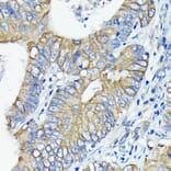 Immunohistochemistry - Anti-DR5 Antibody [ARC0406] (A305494) - Antibodies.com
