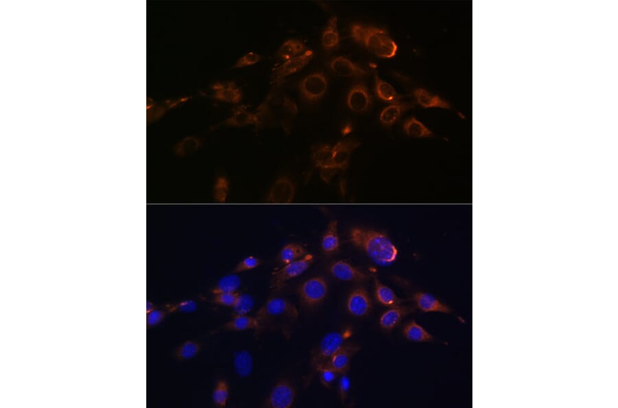 Immunofluorescence - Anti-DR5 Antibody [ARC0406] (A305494) - Antibodies.com