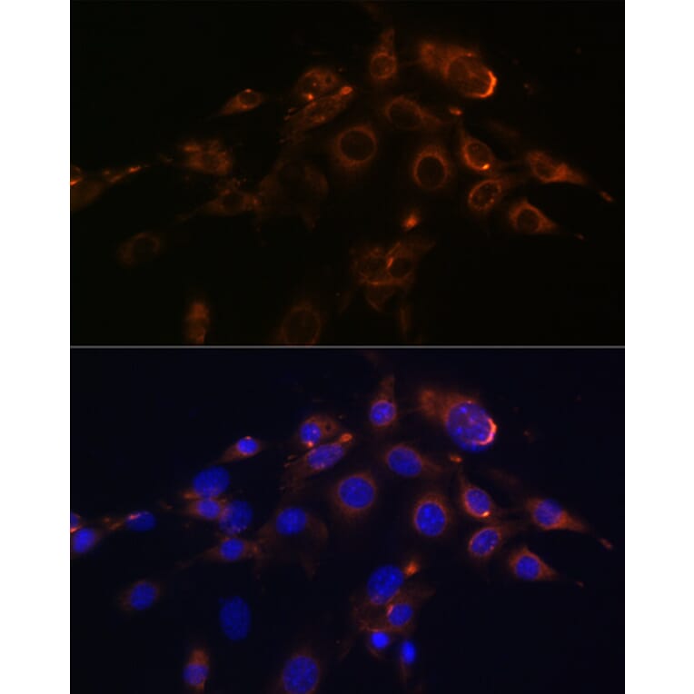 Immunofluorescence - Anti-DR5 Antibody [ARC0406] (A305494) - Antibodies.com